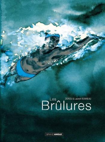 Couverture de l'album Les Brûlures - Histoire complète (One-shot)